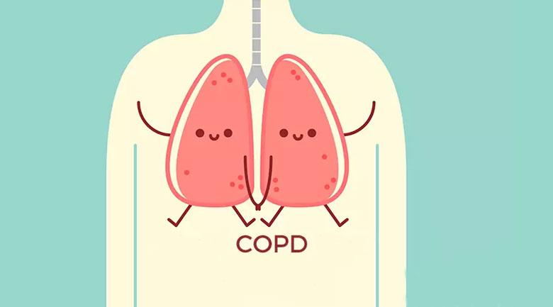 Chronic Obstructive Pulmonary Disease  (COPD)