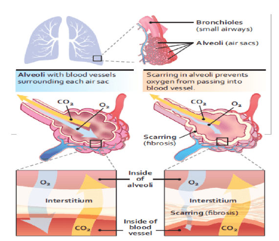 interstitium