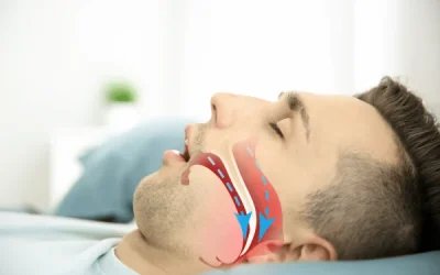 A New Hope for Obstructive Sleep Apnea: FDA-Approved Weight Loss Drug Set for India Launch